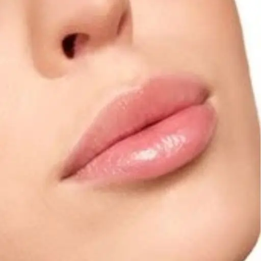 Lip Pigmentation